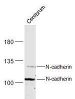 N-cadherin Antibody in Western Blot (WB)