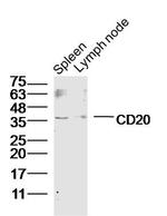 CD20 Antibody in Western Blot (WB)