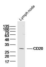 CD20 Antibody in Western Blot (WB)