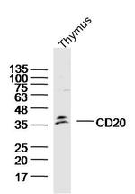 CD20 Antibody in Western Blot (WB)