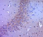 DLG4 Antibody in Immunohistochemistry (Paraffin) (IHC (P))