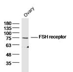 FSH Receptor Antibody in Western Blot (WB)
