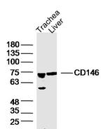CD146 Antibody in Western Blot (WB)
