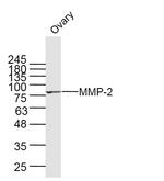 MMP2 Antibody in Western Blot (WB)