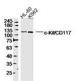 KIT Antibody in Western Blot (WB)