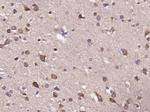 Dopamine D2 Receptor Antibody in Immunohistochemistry (Paraffin) (IHC (P))