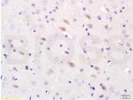 iNOS Antibody in Immunohistochemistry (Paraffin) (IHC (P))