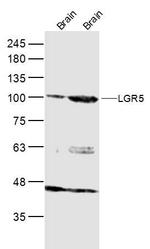 GPR49/LGR5 Antibody in Western Blot (WB)