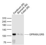 GPR49/LGR5 Antibody in Western Blot (WB)