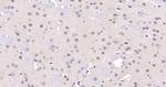 PARP1 Antibody in Immunohistochemistry (Paraffin) (IHC (P))