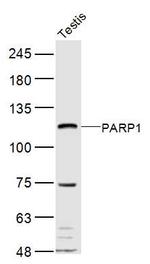 PARP1 Antibody in Western Blot (WB)