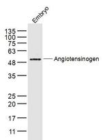 Angiotensinogen Antibody in Western Blot (WB)