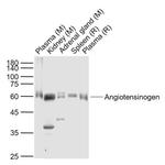 Angiotensinogen Antibody in Western Blot (WB)