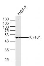 KRT81 Antibody in Western Blot (WB)