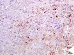 Estrogen Receptor alpha Antibody in Immunohistochemistry (Paraffin) (IHC (P))