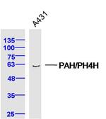 PAH/PH4H Antibody in Western Blot (WB)