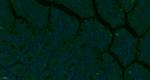 TEM1/CD248 Antibody in Immunohistochemistry (Paraffin) (IHC (P))