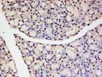 TNFAIP1 Antibody in Immunohistochemistry (Paraffin) (IHC (P))