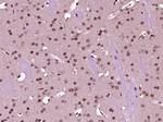 p66 alpha/GATAD2A Antibody in Immunohistochemistry (Paraffin) (IHC (P))