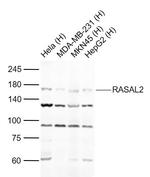 RASAL2 Antibody in Western Blot (WB)