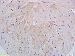 Cyp2-j3 Antibody in Immunohistochemistry (Paraffin) (IHC (P))
