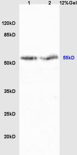 Cyp2-j3 Antibody in Western Blot (WB)