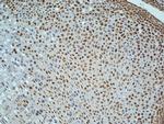 Ki-67 proliferation Marker Antibody in Immunohistochemistry (Paraffin) (IHC (P))
