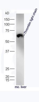 Thrombin light chain Antibody in Western Blot (WB)