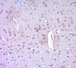 PARP1 Antibody in Immunohistochemistry (Paraffin) (IHC (P))