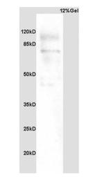 PARP1 Antibody in Western Blot (WB)