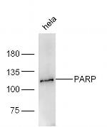 PARP1 Antibody in Western Blot (WB)