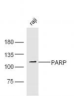 PARP1 Antibody in Western Blot (WB)