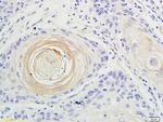 IL-17 Antibody in Immunohistochemistry (Paraffin) (IHC (P))