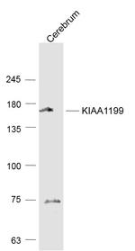 KIAA1199 Antibody in Western Blot (WB)