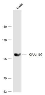 KIAA1199 Antibody in Western Blot (WB)