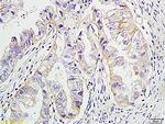 ErbB2 Antibody in Immunohistochemistry (Paraffin) (IHC (P))
