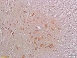 NMDAR1 Antibody in Immunohistochemistry (Paraffin) (IHC (P))