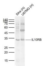 IL10RB Antibody in Western Blot (WB)