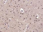 Phospho-GEF H1 (Ser886) Antibody in Immunohistochemistry (Paraffin) (IHC (P))