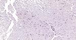 IL-1RA Antibody in Immunohistochemistry (Paraffin) (IHC (P))