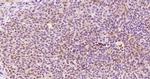 KRG2/DDX11 Antibody in Immunohistochemistry (Paraffin) (IHC (P))