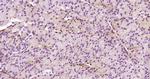 KRG2/DDX11 Antibody in Immunohistochemistry (Paraffin) (IHC (P))