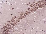 bFGF Antibody in Immunohistochemistry (Paraffin) (IHC (P))