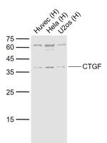 CTGF Antibody in Western Blot (WB)