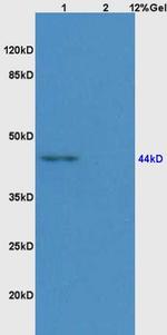 CD209 Antibody in Western Blot (WB)