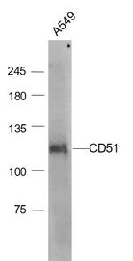 Integrin alpha V/CD51 Antibody in Western Blot (WB)