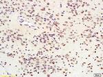 SIRT1/sirtuin 1 Antibody in Immunohistochemistry (Paraffin) (IHC (P))
