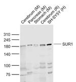 SUR1 Antibody in Western Blot (WB)