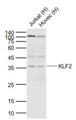 KLF2 Antibody in Western Blot (WB)
