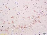 Phospho-STMN2/SCG10 (Ser50) Antibody in Immunohistochemistry (Paraffin) (IHC (P))